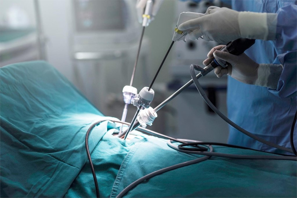 La eficacia de la cirugía laparoscópica en el tratamiento de problemas colorrectales