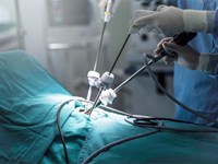 La eficacia de la cirugía laparoscópica en el tratamiento de problemas colorrectales
